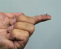 1cm volume
